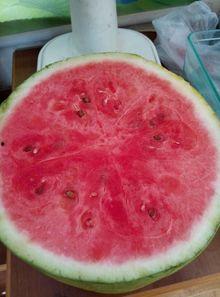 医院吃的瓜,揭秘医疗界的酸甜苦辣